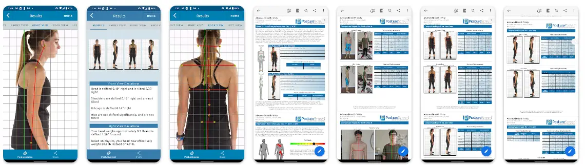 PostureScreen Mobile Evaluación de Postura